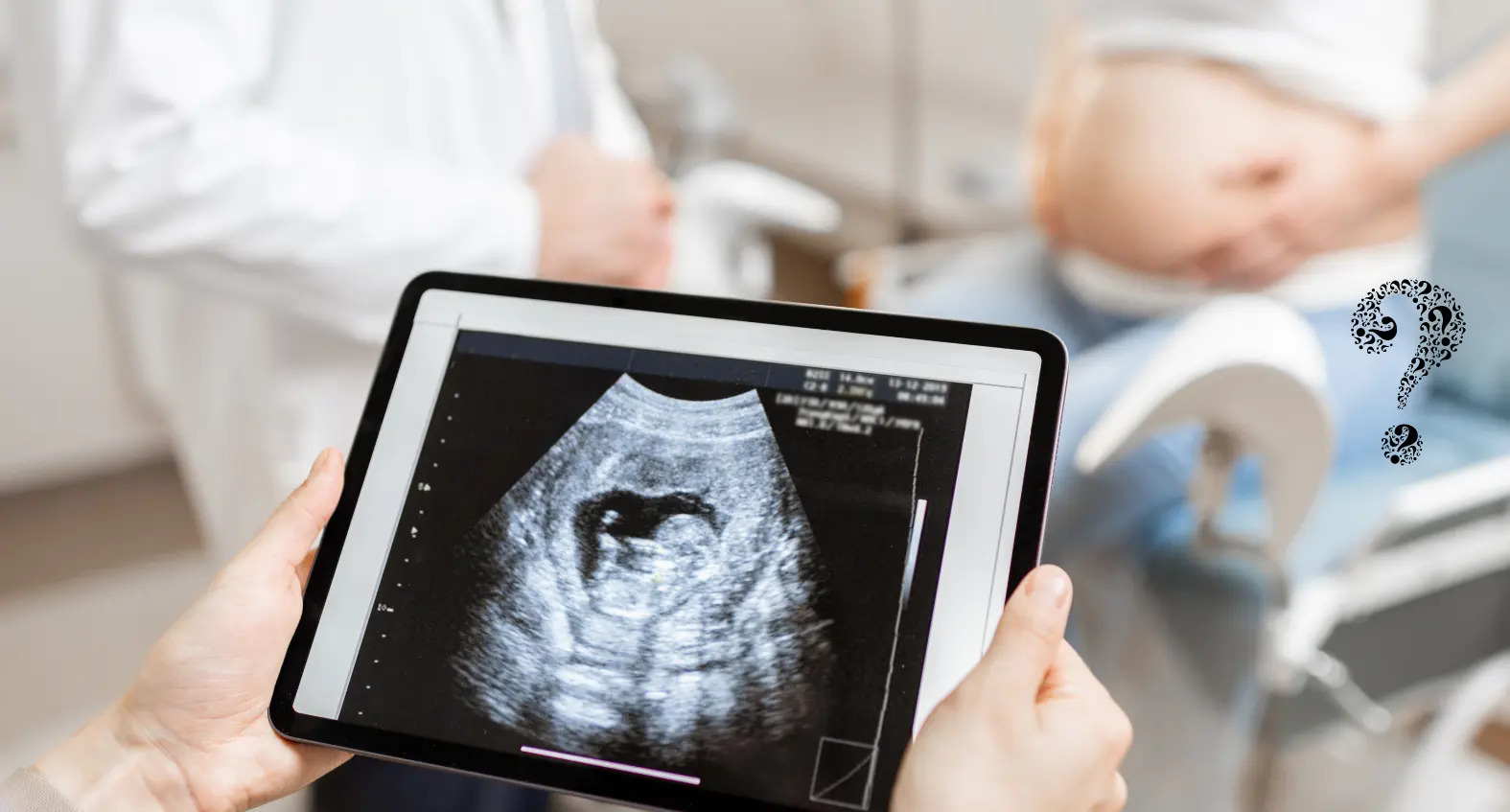 10 Weeks Pregnant 3D Ultrasound: What to Expect and Why It Matters What to Expect During the Scan