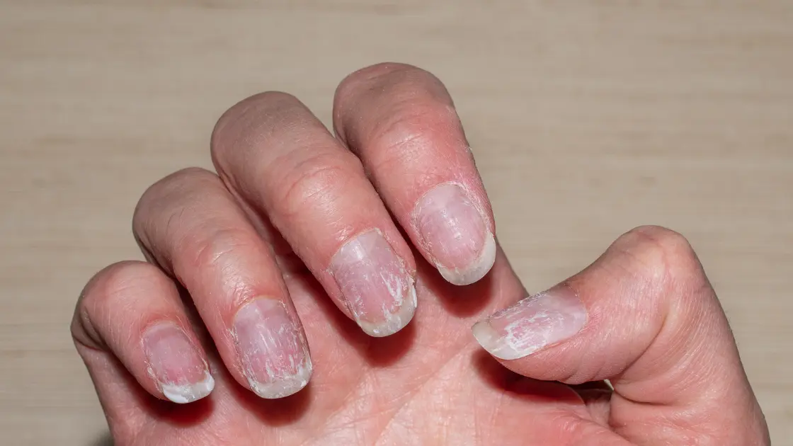 Pregnancy Nail Shapes: Healthy Nails with Stylish Care Brittle Nails