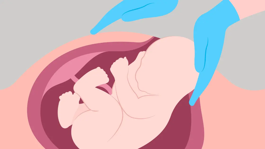 Posterior Placenta: A Critical Pregnancy Fact Decoded Posterior Placenta