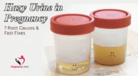 Hazy Urine in Pregnancy – 7 Root Causes & Fast Fixes