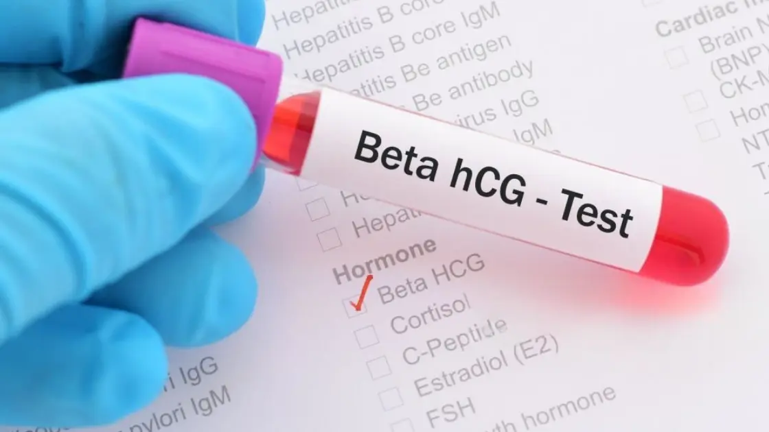 HCG Calculator: Track Twin Pregnancy Signs Like a Pro How HCG Works in Pregnancy