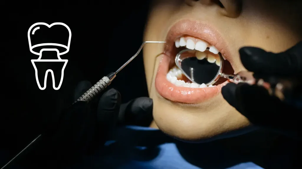 How to Fix a Chipped Tooth in Toddlers 