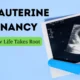 Intrauterine Pregnancy_ Where New Life Takes Root