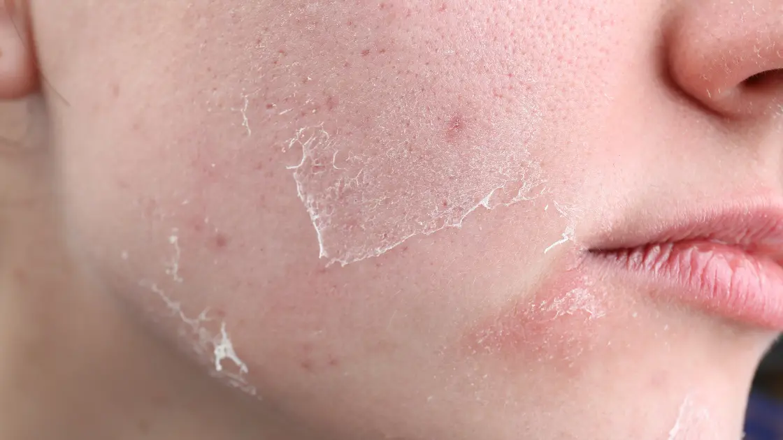 Best Pregnancy Safe Skincare Routine – Simple & Safe Pregnancy Skin Concerns and Safe Solutions