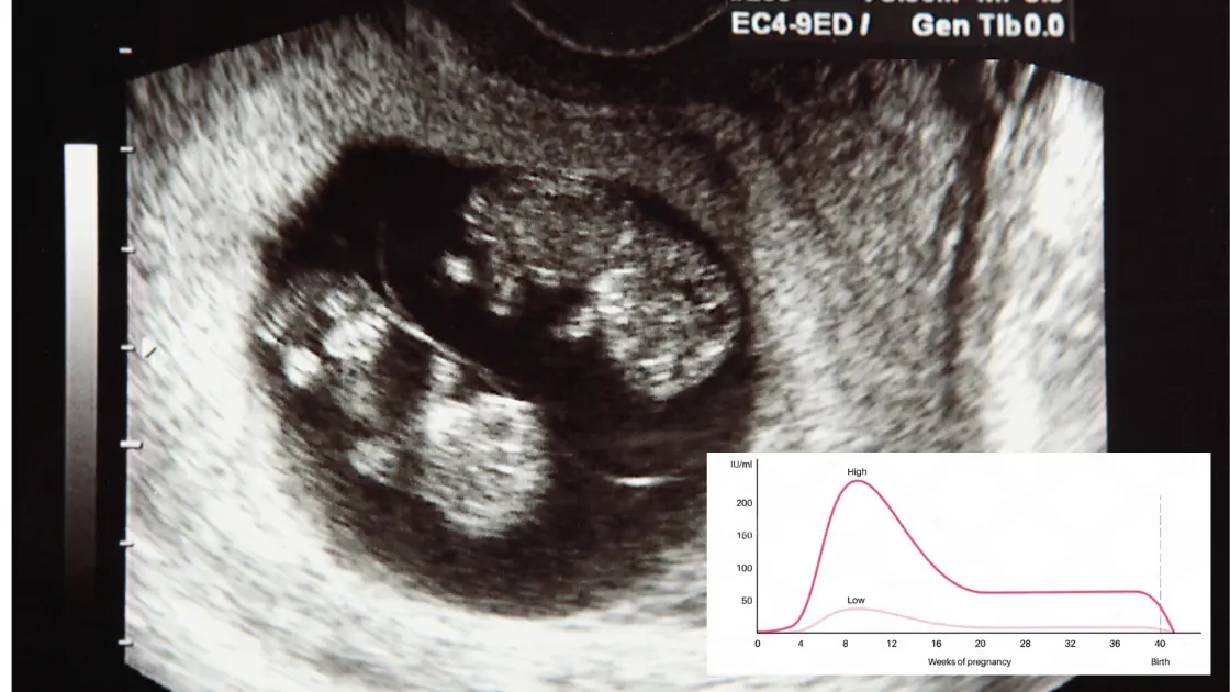 Can Twins Cause False Negative Pregnancy Test? Find Out! Twin Pregnancies hCG Levels