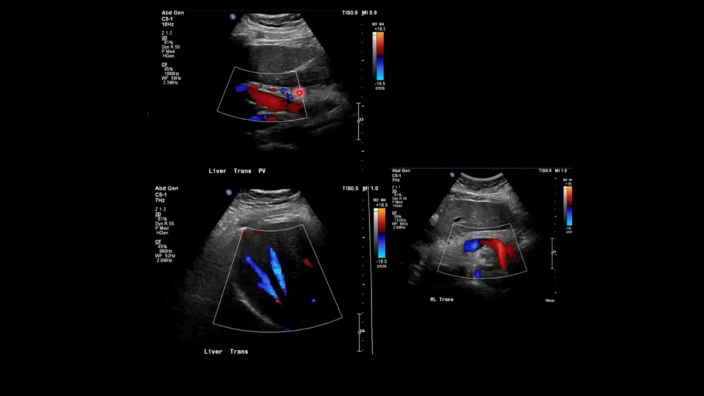 Fetal Scalp Electrode: A Lifeline in Complicated Pregnancies fetal scalp electrodes