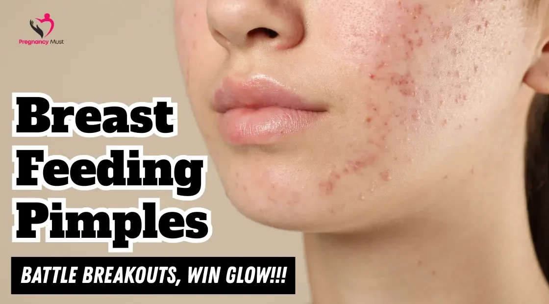 Breastfeeding Pimples
