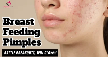Breastfeeding Pimples
