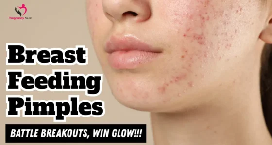 Breastfeeding Pimples