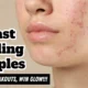 Breastfeeding Pimples