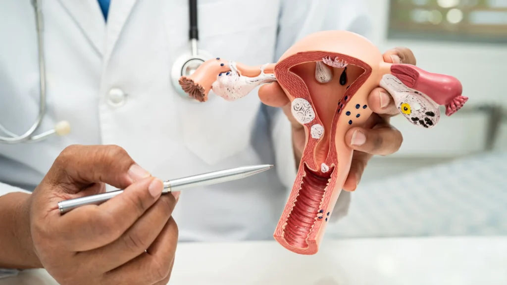 Anteverted Uterus: A Hidden Advantage in Fertility & Pregnancy what is an anteverted uterus