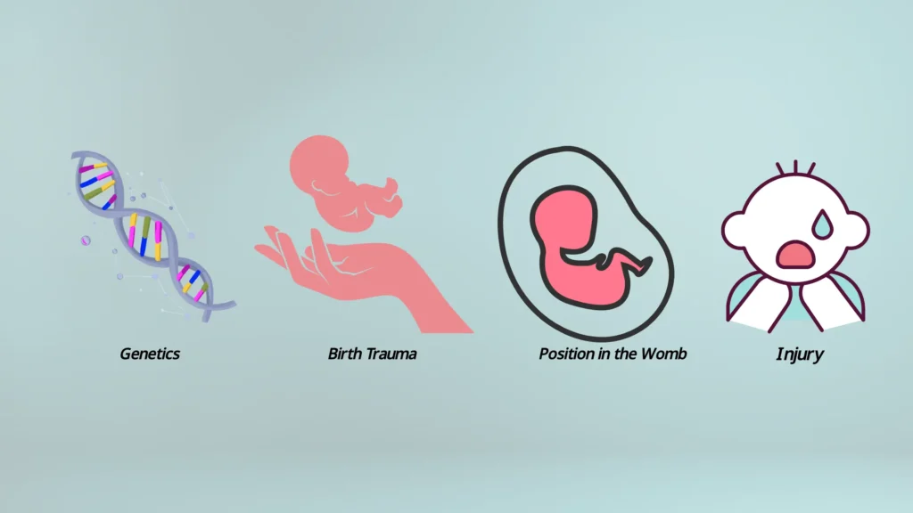Nose Shapes in Babies: 5 Ways to Address Common Defects nose shapes