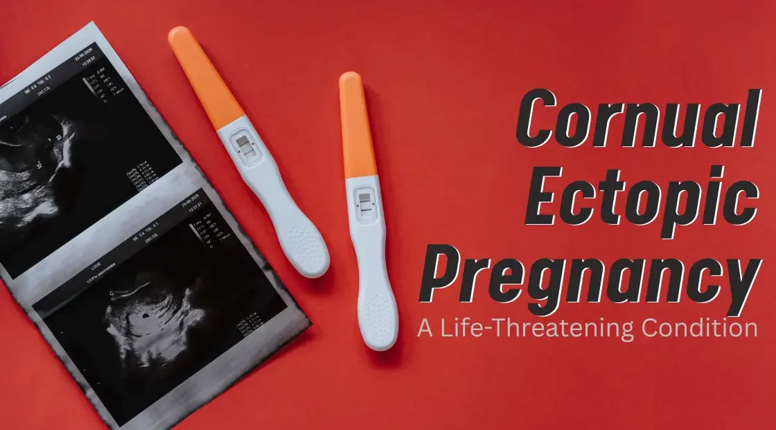 Cornual Ectopic Pregnancy