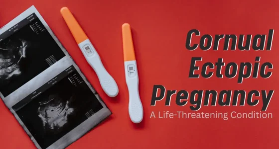 Cornual Ectopic Pregnancy