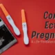 Cornual Ectopic Pregnancy