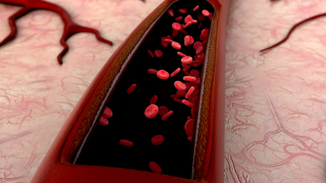 Polycythemia ICD 10 in Kids: Hope and Healing Ahead Polycythemia ICD 10