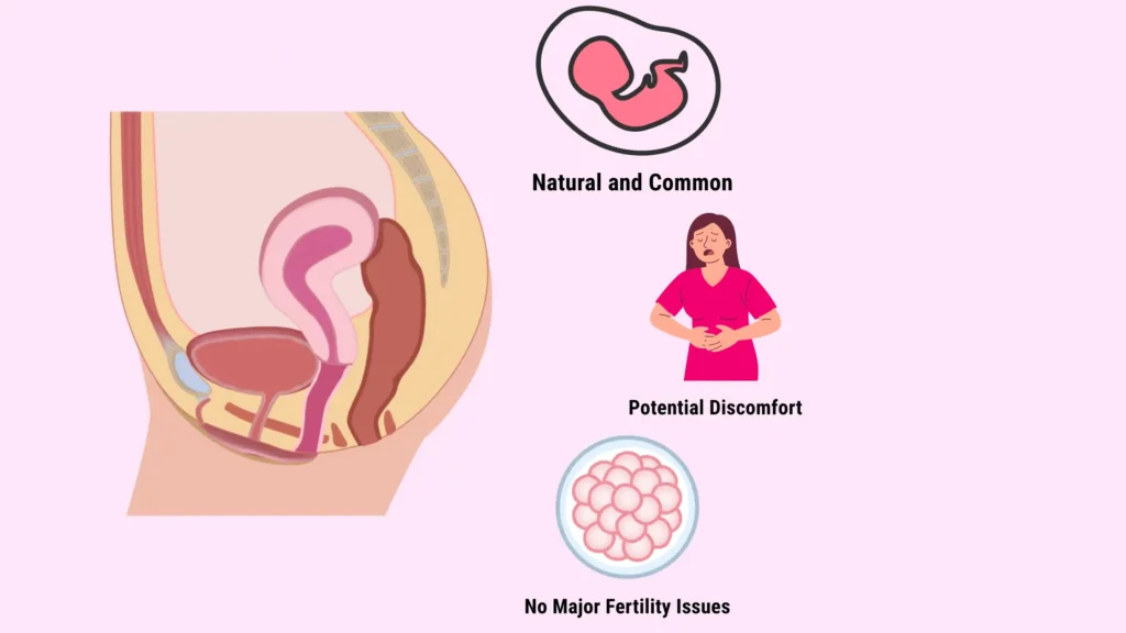 Anteverted Uterus: A Hidden Advantage in Fertility & Pregnancy anteverted anteflexed uterus