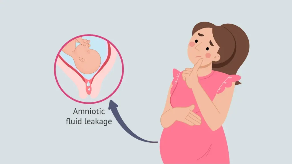 leaking amniotic fluid signs