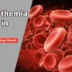 Polycythemia ICD 10