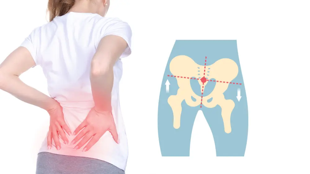 Best Brace for Anterior Pelvic Tilt