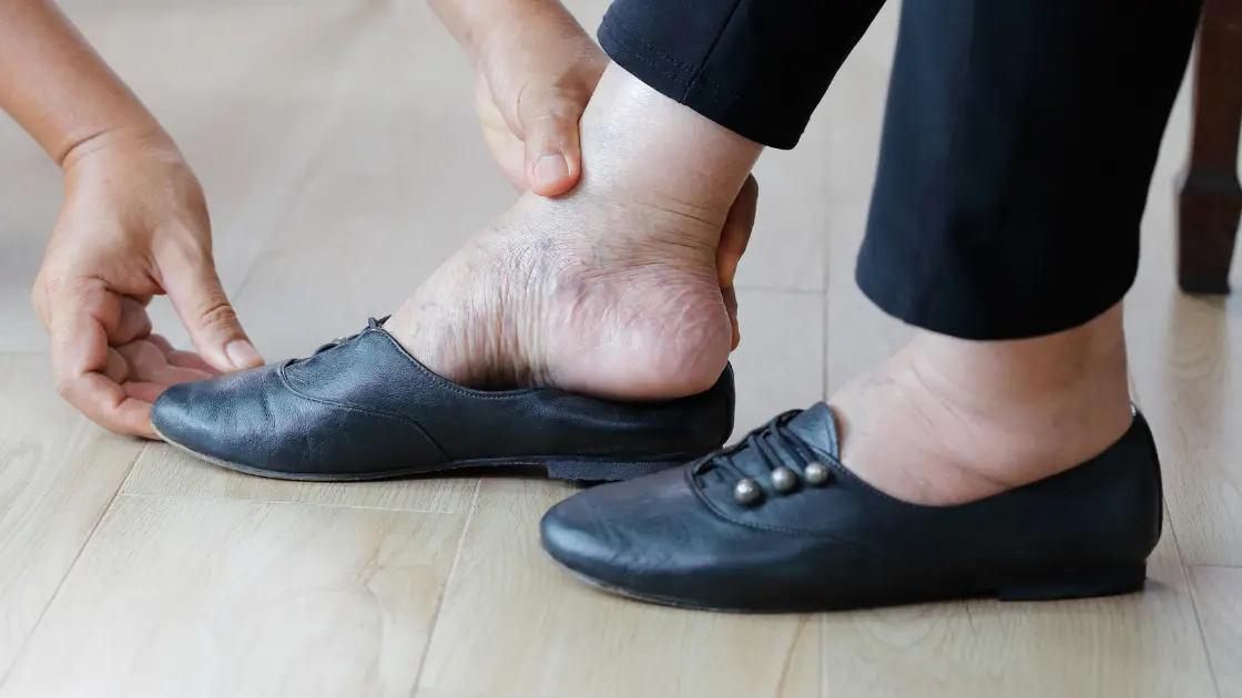 Shoes for Swollen Feet