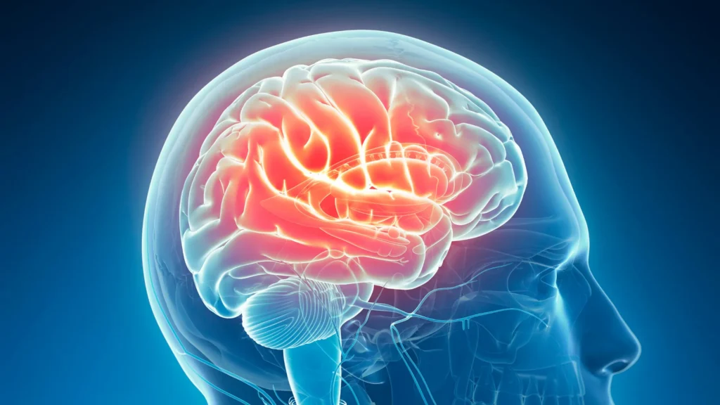 Tooth Infection Spread to the Brain