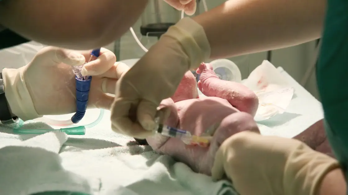 rh isoimmunization