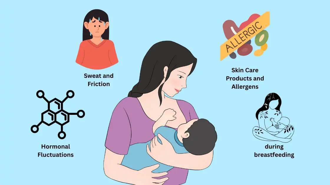 Breastfeeding pimples