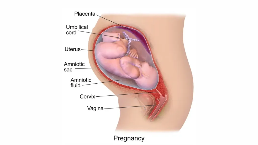 amniotic fluid leak