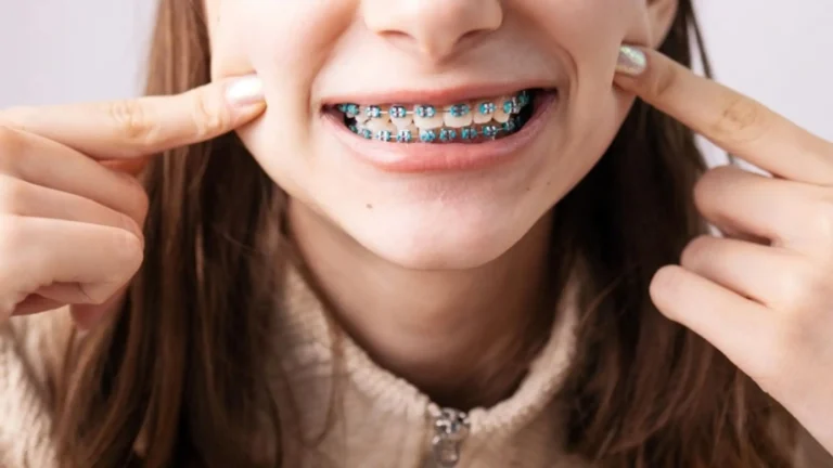 Braces for kids