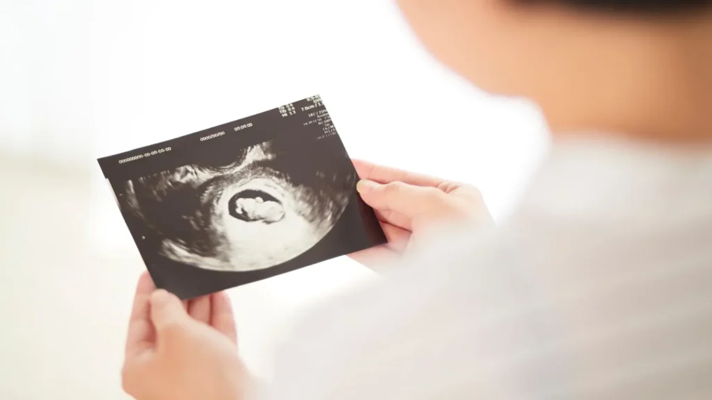 Complications of Cryptic Pregnancy