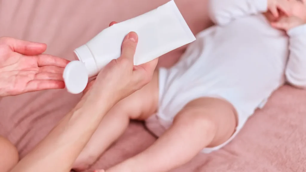 How to Treat Baby Eczema
