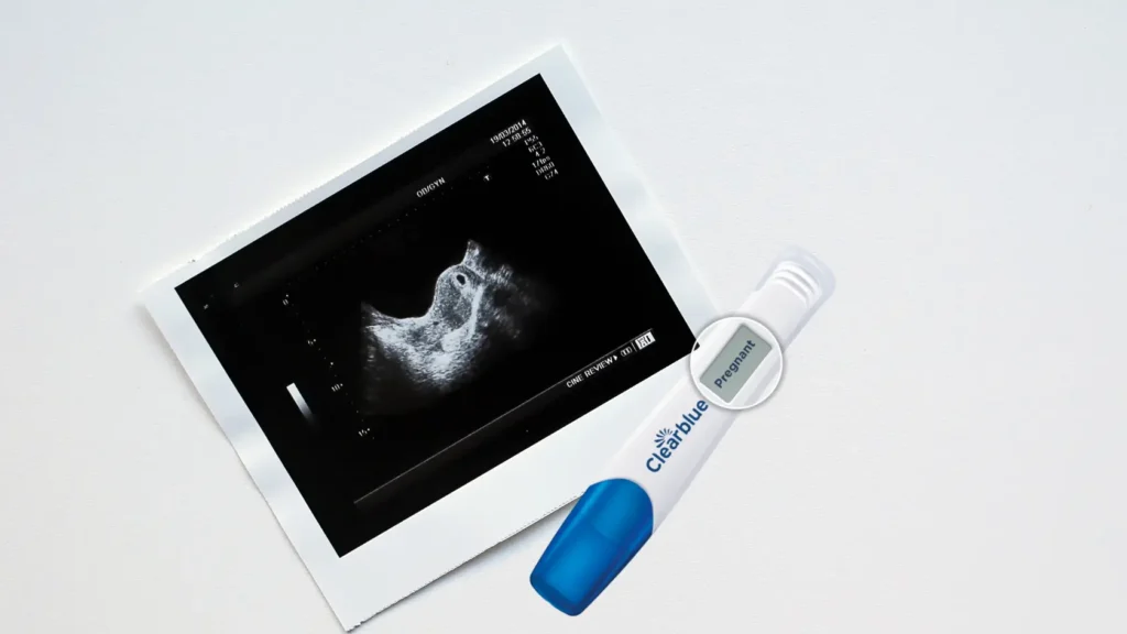 Why Choose the Clear Blue Pregnancy Test Kit?